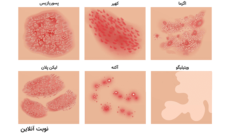 لیست کامل بیماری‌ های پوستی و علائم آن‌