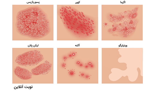 لیست کامل بیماری‌ های پوستی و علائم آن‌